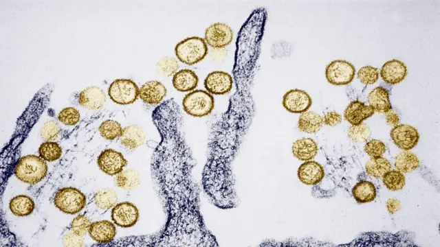 Qué es el hantavirus y cuáles son los síntomas del virus que causó 3 muertes en un crucero que se dirige a España
