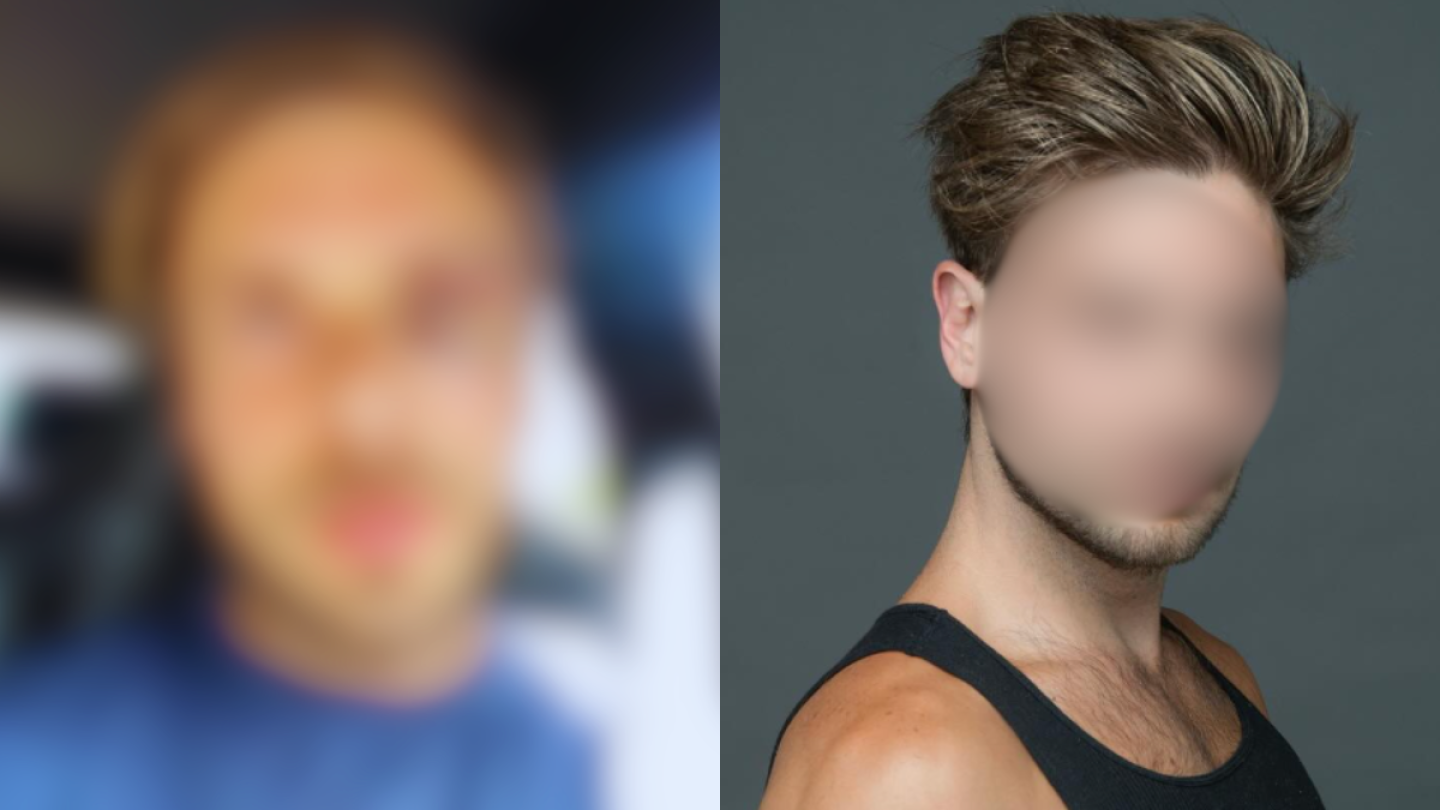 Actor mexicano de telenovelas fue brutalmente golpeado, ¿lo dejaron desfigurado y sin poder ver? VIDEO