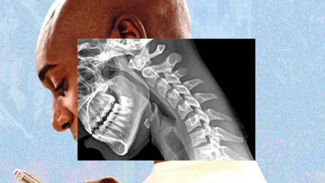 “Cuerpo de teléfono”: cómo la tecnología nos arruga el cuello y debilita las manos