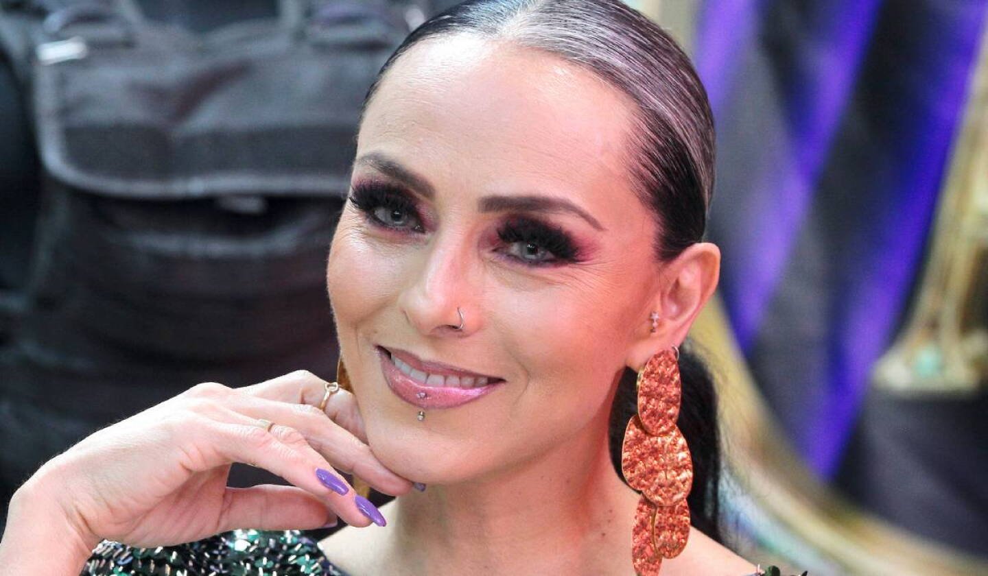 Ivonne Montero revela daño facial por un tratamiento estético que salió mal: “Me quemó”| VIDEO