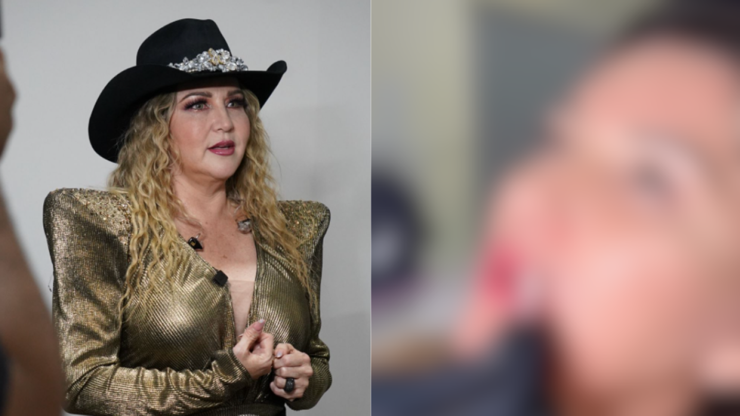 Alicia Villarreal se somete a procedimiento estético y… ¿queda irreconocible? ¡Se inyectó! VIDEO