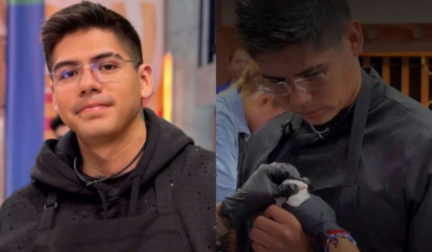 Antrax reaparece tras accidente en ‘MasterChef 24/7’ y muestra su dedo, ¿realmente se lo amputaron?