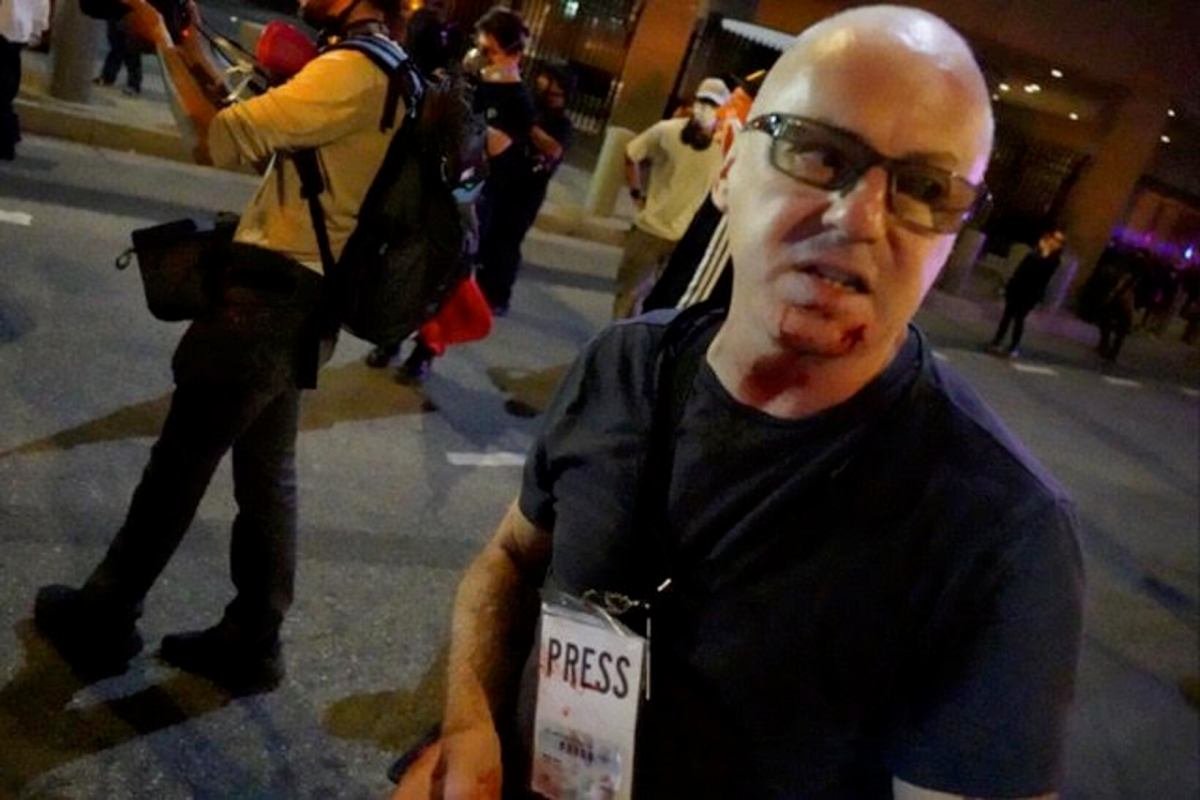 Fotoperiodista demanda a la ciudad de Los Ángeles por agresión policial durante protesta contra ICE