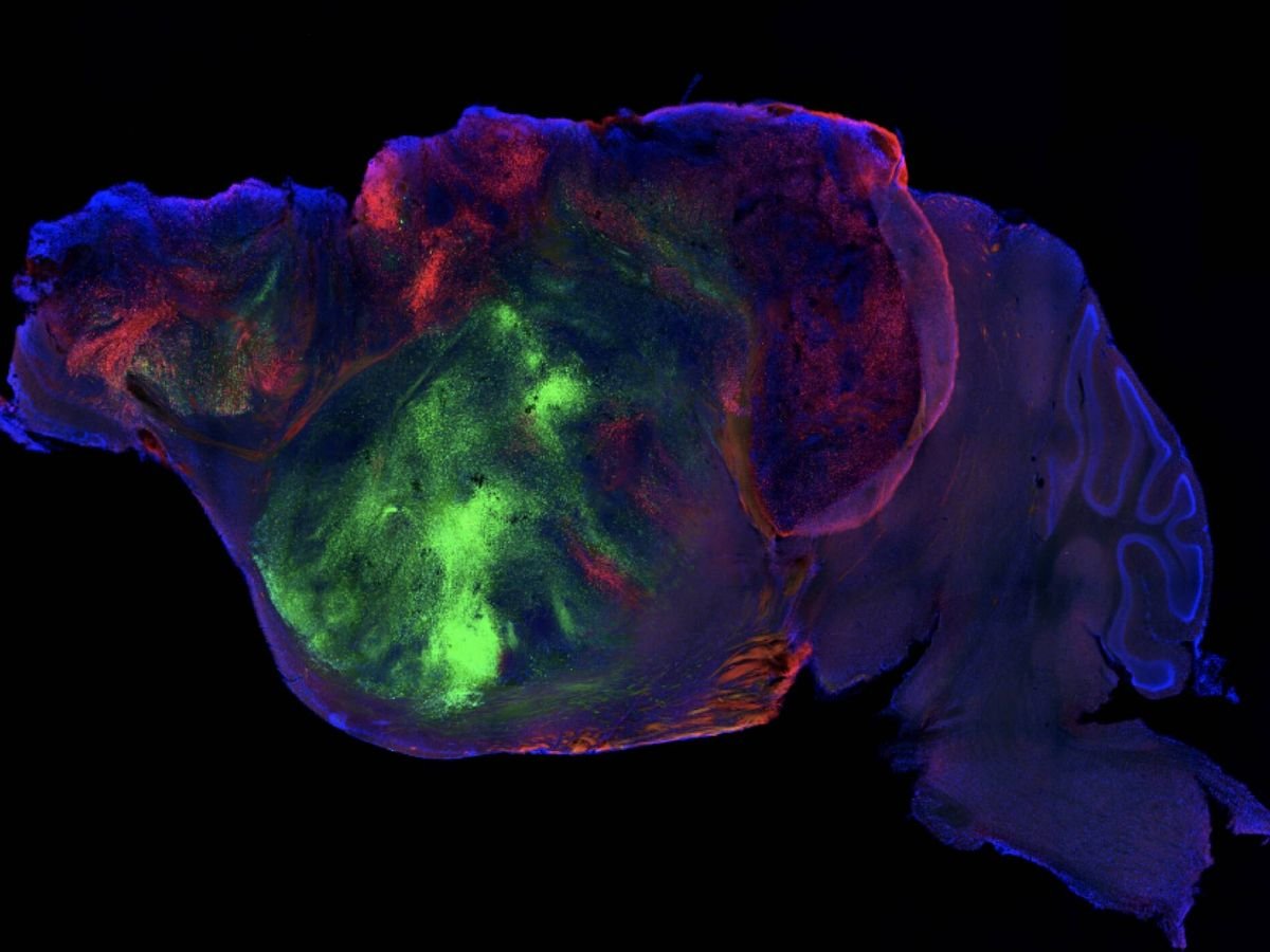 Trasplantan corteza cerebral humana a ratones y lo que sucede es algo que desafía a la biología